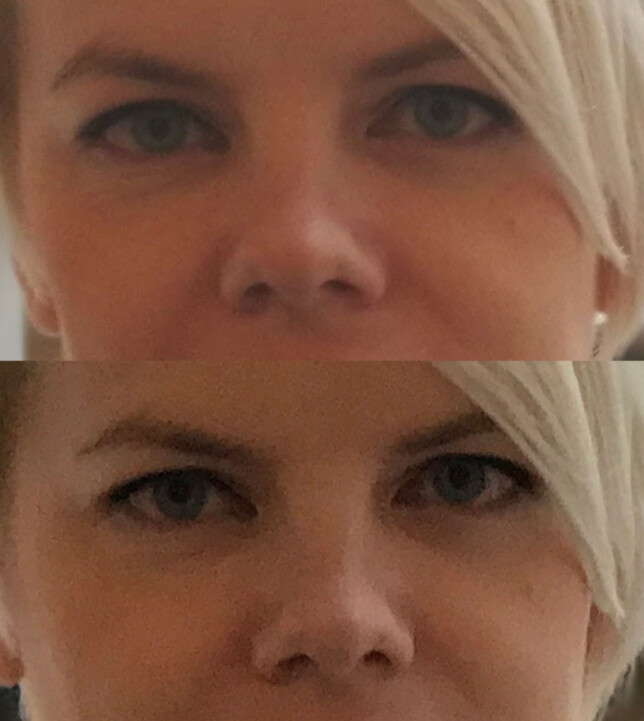 1: